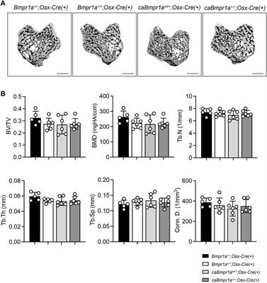 Increased BMP-Smad signaling does not affect net bone mass in long bones